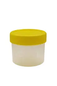 POT SPUTUM